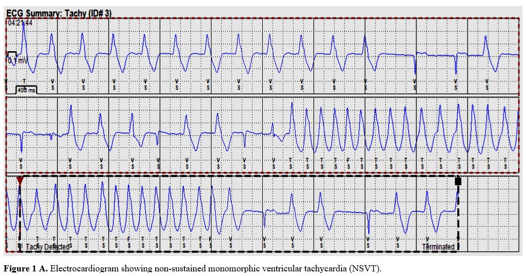 Figure 1A
