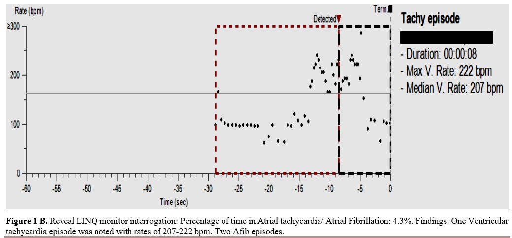 Figure 1B